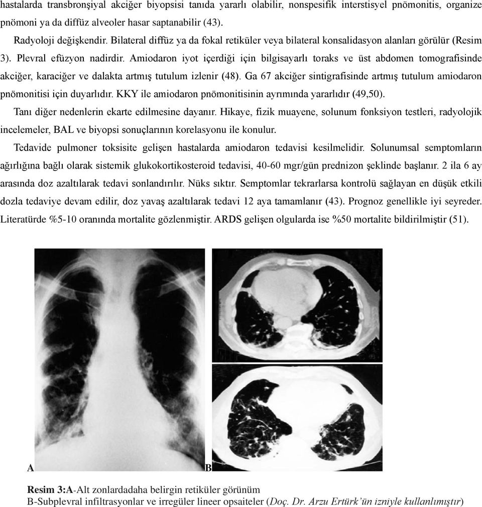 Amiodaron iyot içerdiği için bilgisayarlı toraks ve üst abdomen tomografisinde akciğer, karaciğer ve dalakta artmış tutulum izlenir (48).