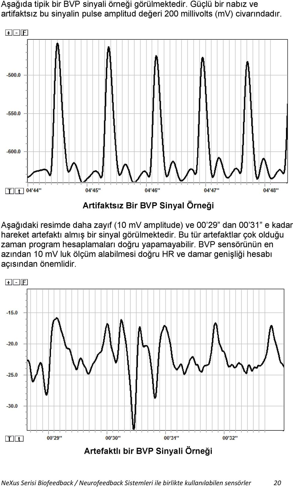 görülmektedir. Bu tür artefaktlar çok olduğu zaman program hesaplamaları doğru yapamayabilir.