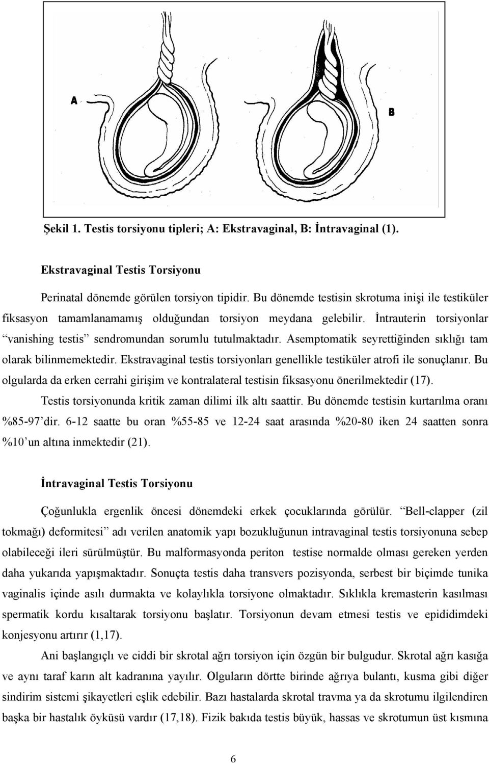 Asemptomatik seyrettiğinden sıklığı tam olarak bilinmemektedir. Ekstravaginal testis torsiyonları genellikle testiküler atrofi ile sonuçlanır.