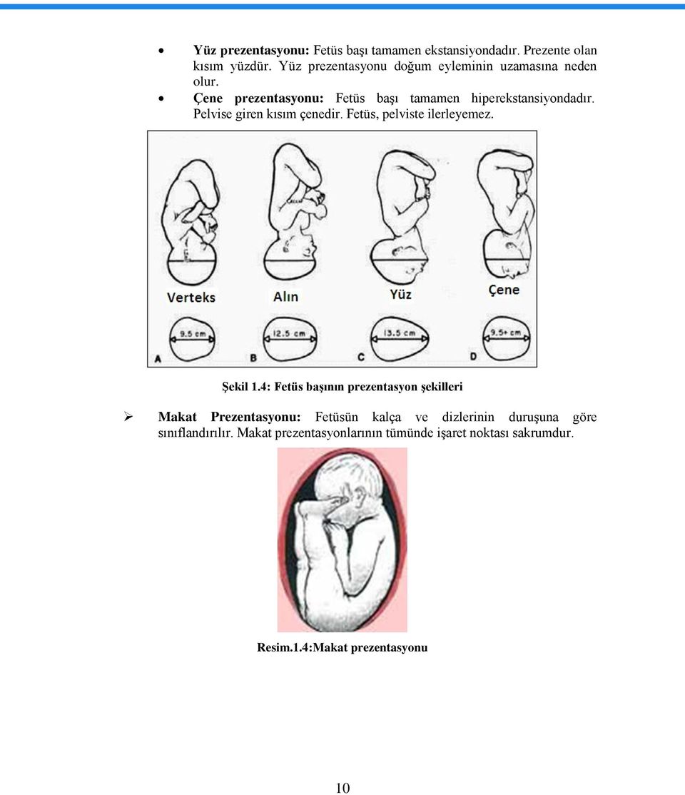 Pelvise giren kısım çenedir. Fetüs, pelviste ilerleyemez. Şekil 1.