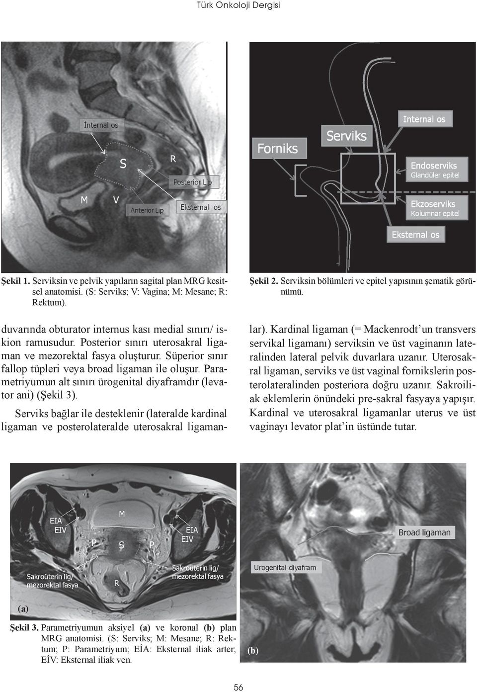 Parametriyumun alt sınırı ürogenital diyaframdır (levator ani) (Şekil 3). Şekil 2. Serviksin bölümleri ve epitel yapısının şematik görünümü.