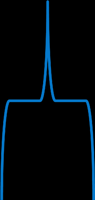 msn Stim QRS: 70