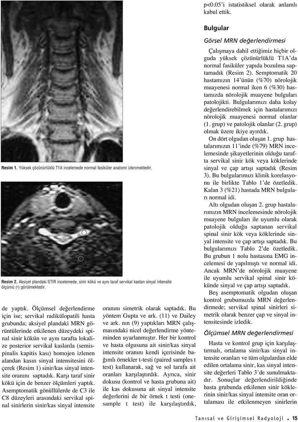 Ölçümsel değerlendirme için ise; servikal radikülopatili hasta grubunda; aksiyel plandaki MRN görüntülerinde etkilenen düzeydeki spinal sinir kökün ve ayn tarafta lokalize posterior servikal kaslarda