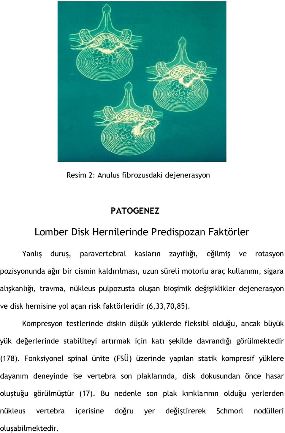 Kompresyon testlerinde diskin düşük yüklerde fleksibl olduğu, ancak büyük yük değerlerinde stabiliteyi artırmak için katı şekilde davrandığı görülmektedir (178).