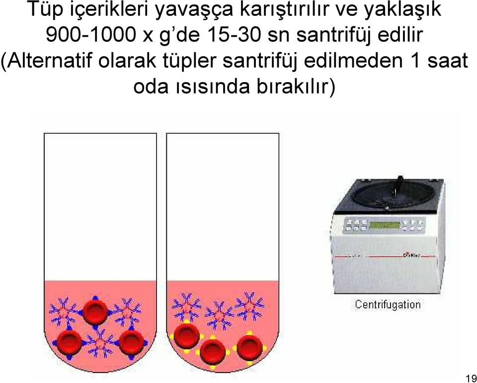 santrifüj edilir (Alternatif olarak tüpler