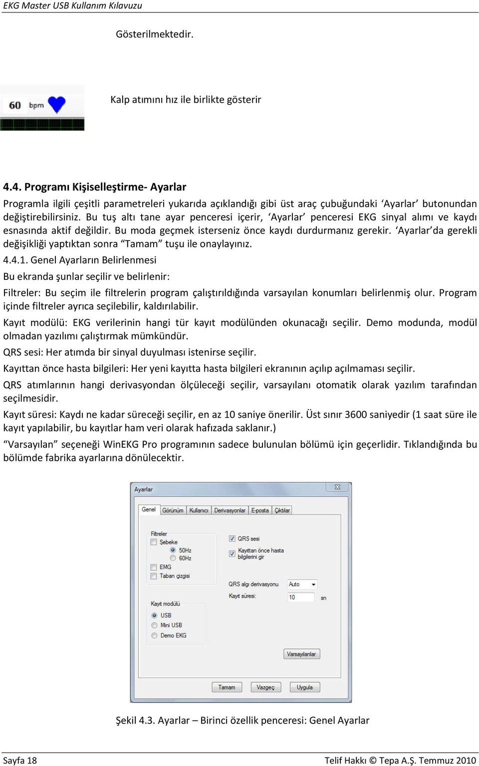 Bu tuş altı tane ayar penceresi içerir, Ayarlar penceresi EKG sinyal alımı ve kaydı esnasında aktif değildir. Bu moda geçmek isterseniz önce kaydı durdurmanız gerekir.