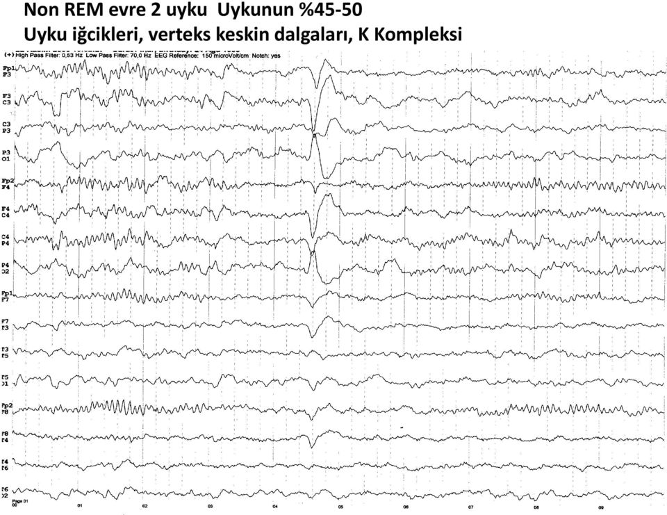 iğcikleri, verteks