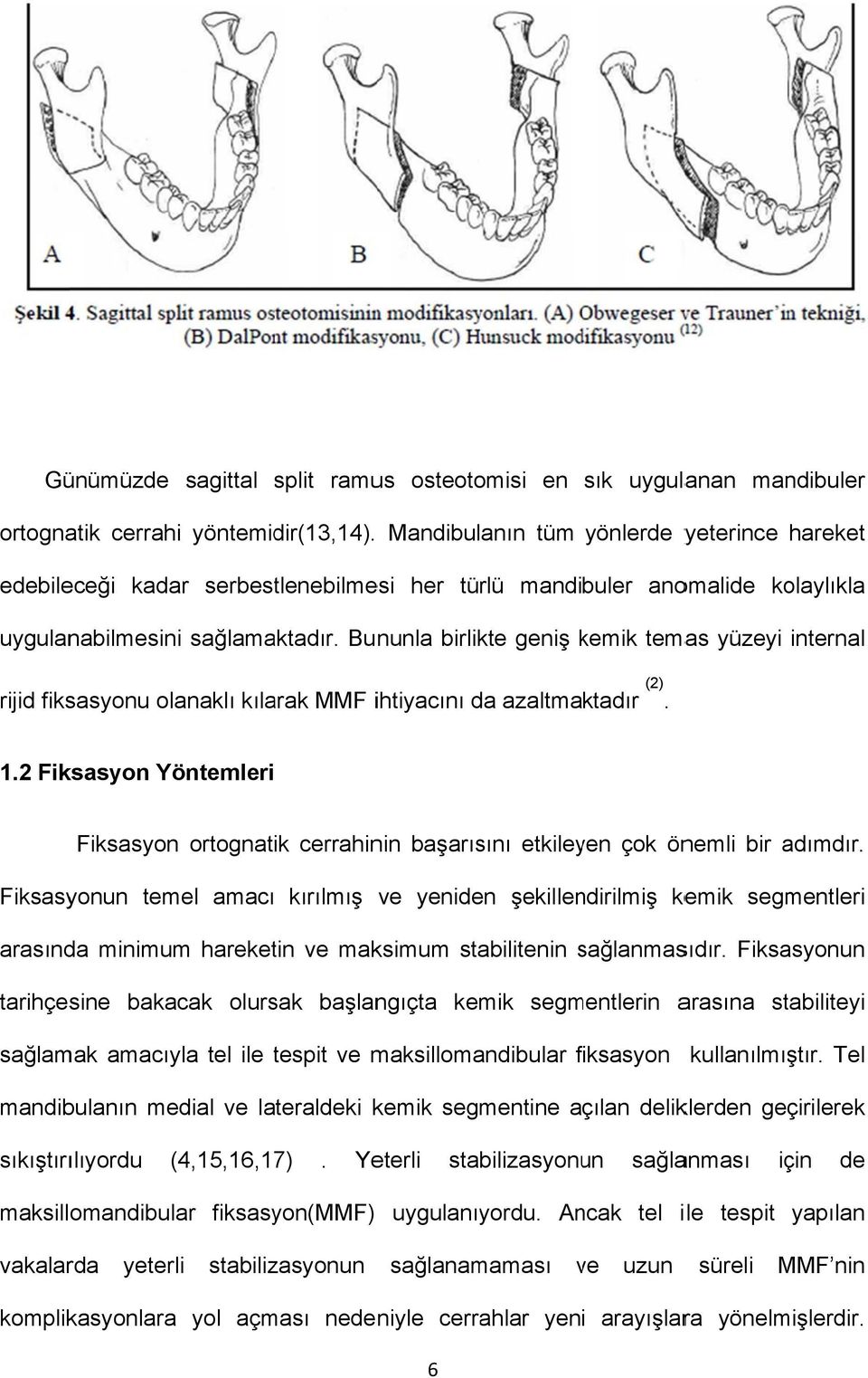 Bununla birlikte geniş kemik k temas yüzeyi internal rijid fiksasyonu olanaklı kılarak MMF ihtiyacını da azaltmaktadır (2). 1.