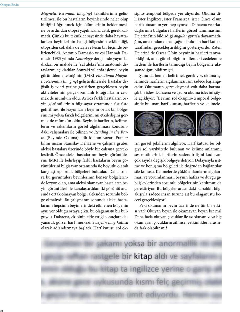 Antonio Damasio ve eşi Hannah Damasio 1983 yılında Neurology dergisinde yayımladıkları bir makale ile saf aleksi nin anatomik detaylarını açıkladılar.