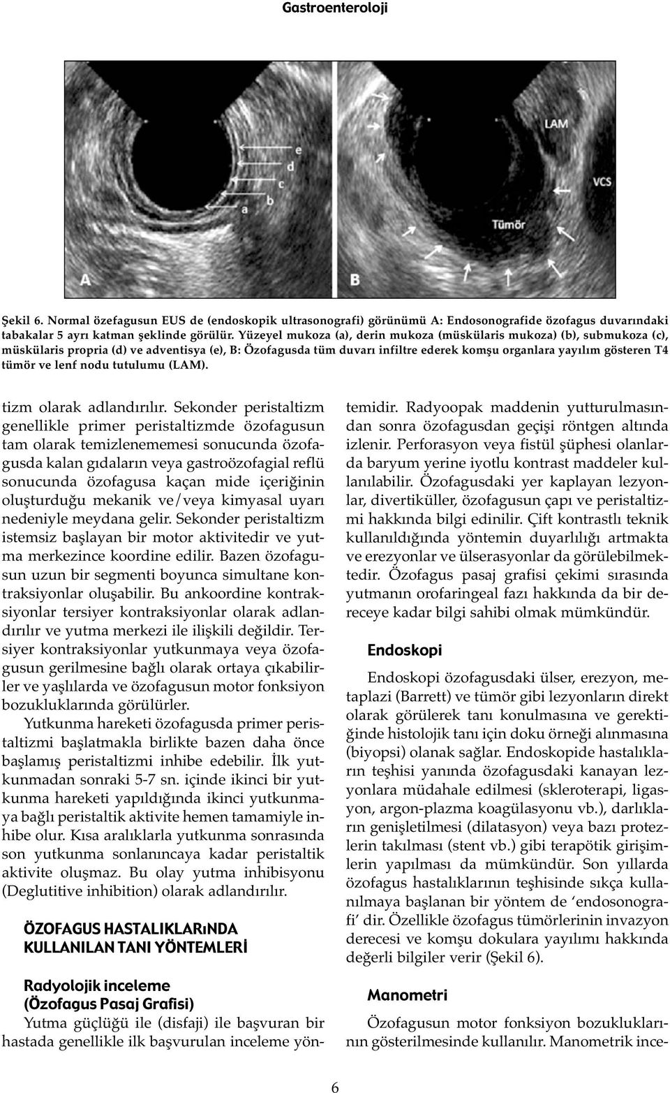 ve lenf nodu tutulumu (LAM). tizm olarak adlandırılır.