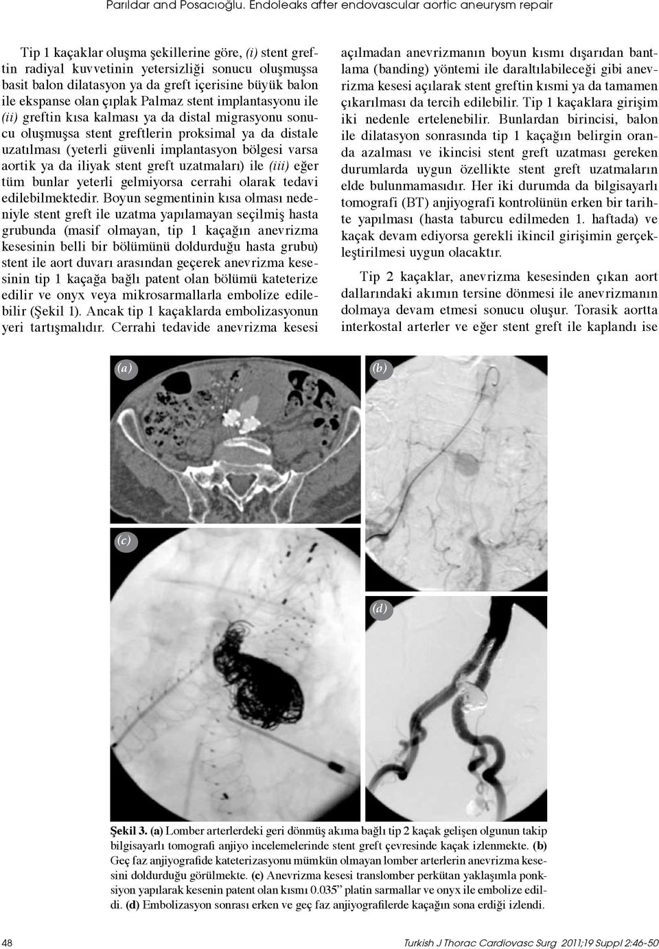 içerisine büyük balon ile ekspanse olan çıplak Palmaz stent implantasyonu ile (ii) greftin kısa kalması ya da distal migrasyonu sonucu oluşmuşsa stent greftlerin proksimal ya da distale uzatılması