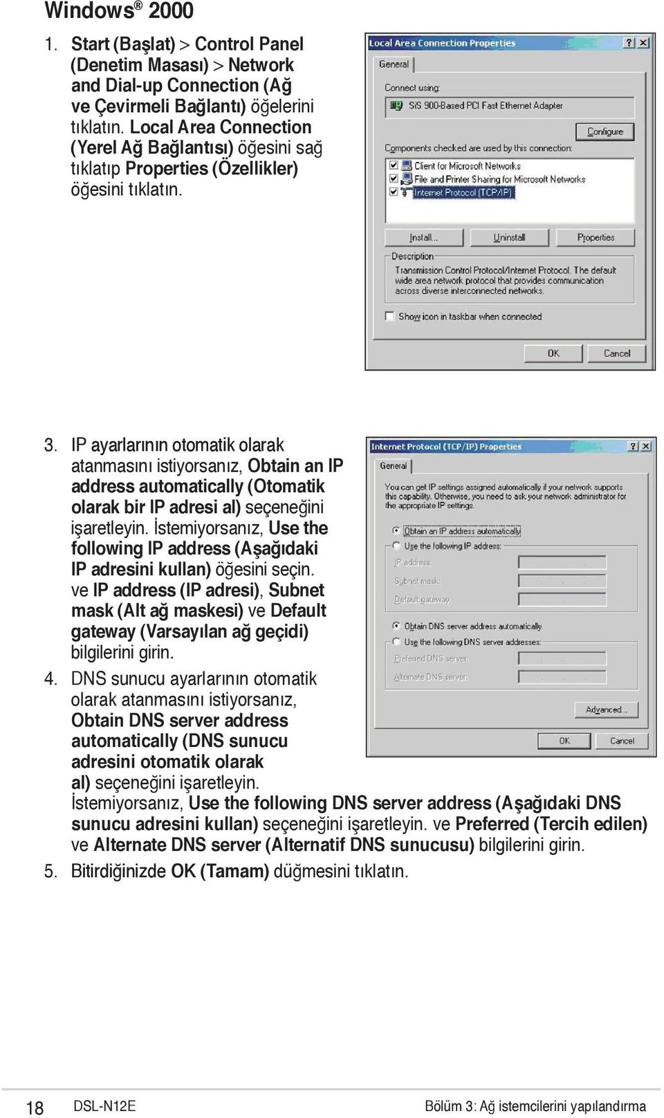 IP ayarlarının otomatik olarak atanmasını istiyorsanız, Obtain an IP address automatically (Otomatik olarak bir IP adresi al) seçeneğini işaretleyin.