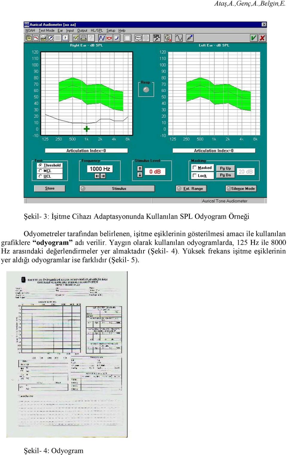 Yaygın olarak kullanılan odyogramlarda, 125 Hz ile 8000 Hz arasındaki değerlendirmeler yer almaktadır