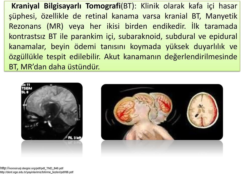 İlk taramada kontrastsız BT ile parankim içi, subaraknoid, subdural ve epidural kanamalar, beyin ödemi tanısını koymada yüksek