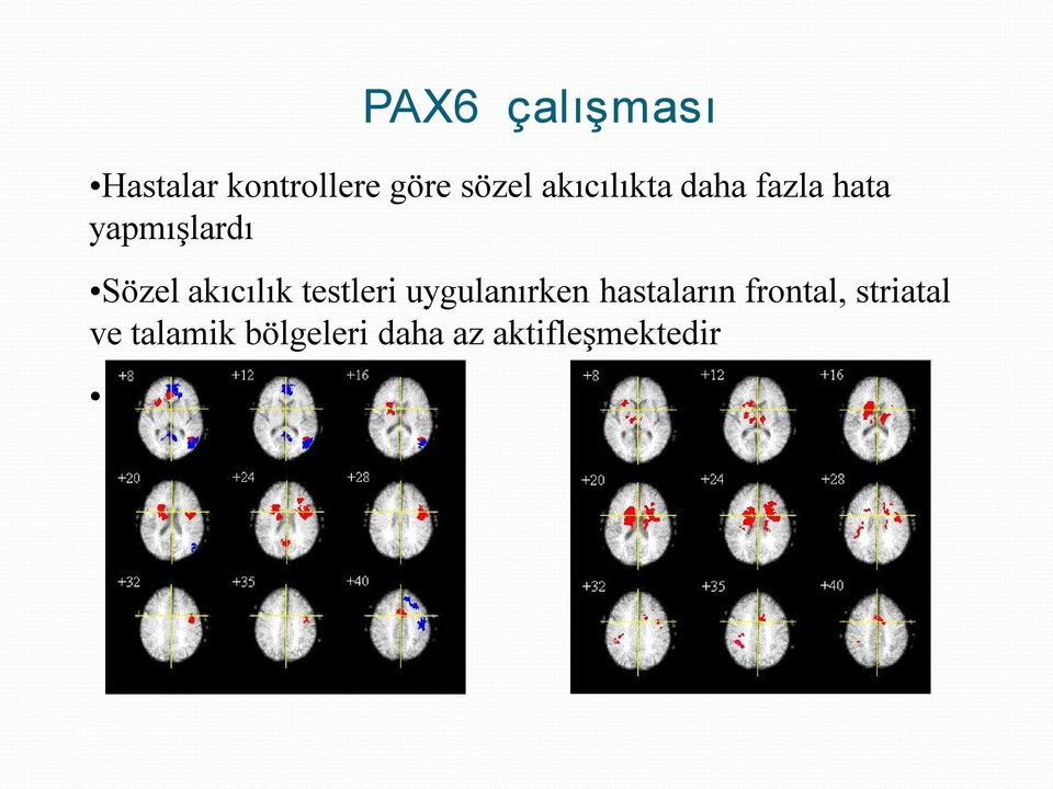 akıcılık testleri uygulanırken hastaların