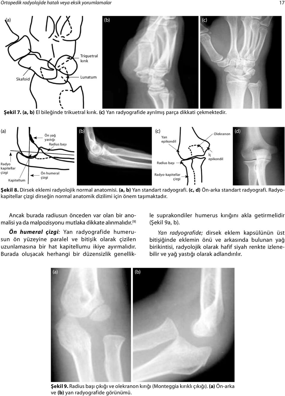 (a) (b) (c) (d) Ön yağ yastığı Radius başı Yan epikondil Olekranon Radyo kapitellar çizgi Kapitellum Ön humeral çizgi Radius başı Radyo-kapitellar çizgi İç epikondil Şekil 8.