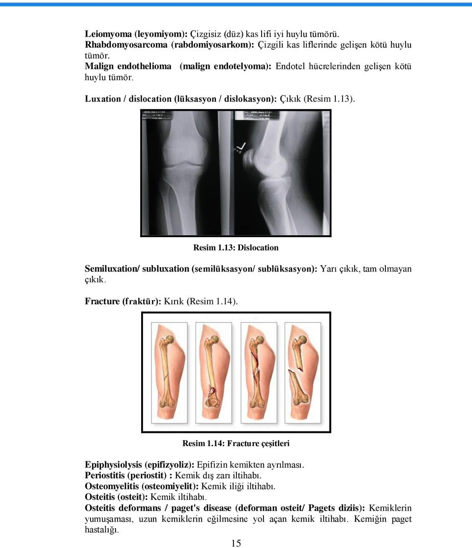 13: Dislocation Semiluxation/ subluxation (semilüksasyon/ sublüksasyon): Yarı çıkık, tam olmayan çıkık. Fracture (fraktür): Kırık (Resim 1.14). Resim 1.