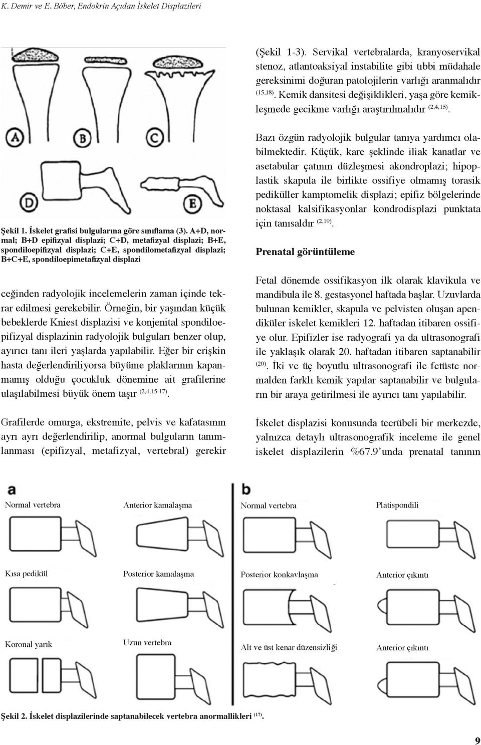 Kemik dansitesi değişiklikleri, yaşa göre kemikleşmede gecikme varlığı araştırılmalıdır (2,4,15). Şekil 1. İskelet grafisi bulgularına göre sınıflama (3).