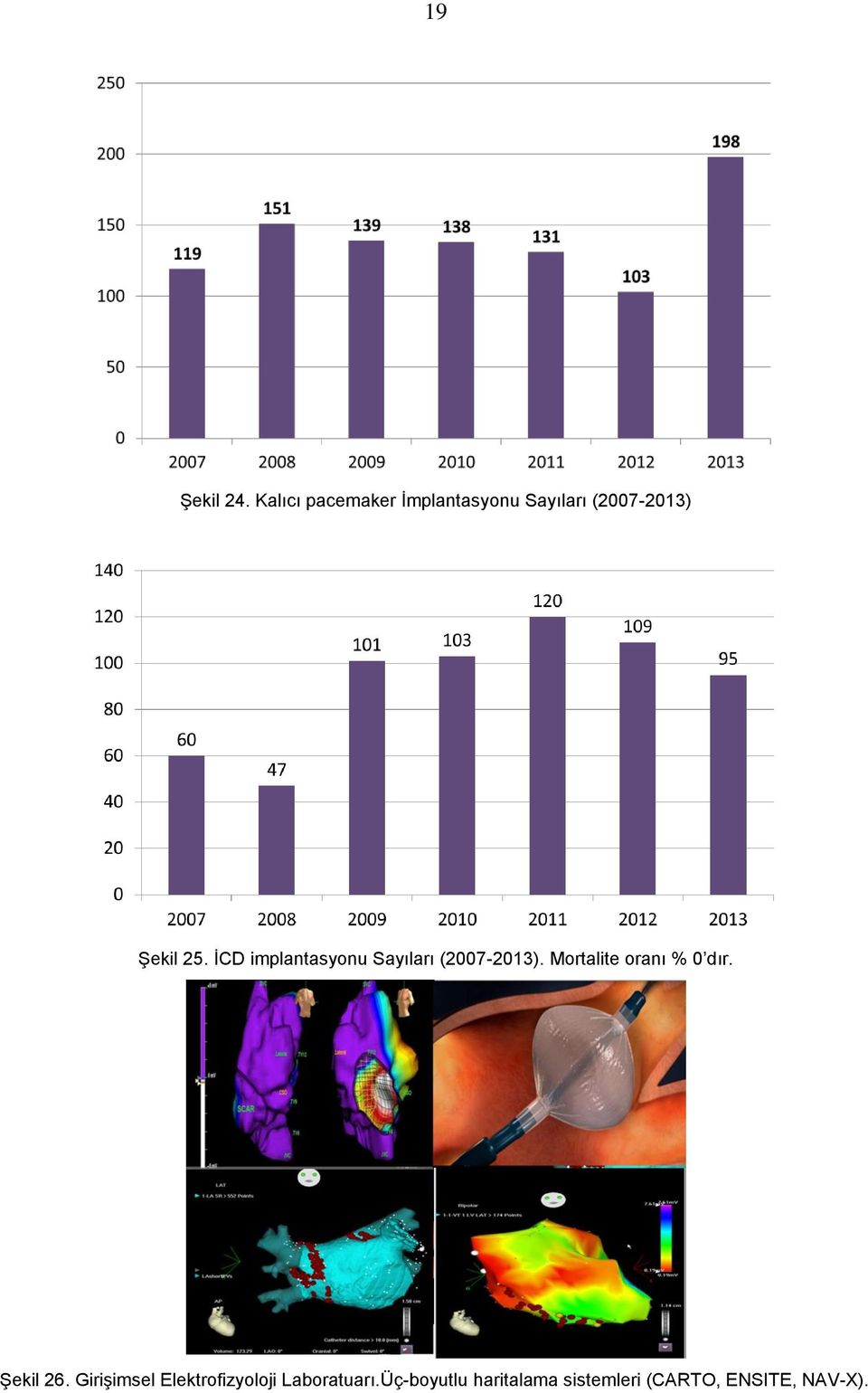 ĠCD implantasyonu Sayıları (2007-2013).