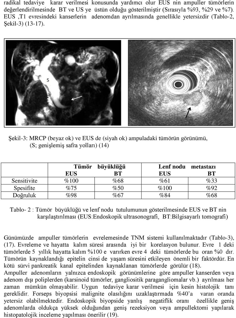 Şekil-3: MRCP (beyaz ok) ve EUS de (siyah ok) ampuladaki tümörün görünümü, (S; genişlemiş safra yolları) (14) Tümör büyüklüğü Lenf nodu metastazı EUS BT EUS BT Sensitivite %100 %68 %61 %33 Spesifite