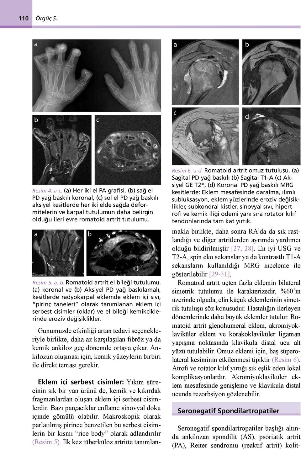 romatoid artrit tutulumu. a b Resim 5. a, b. Romatoid artrit el bileği tutulumu.