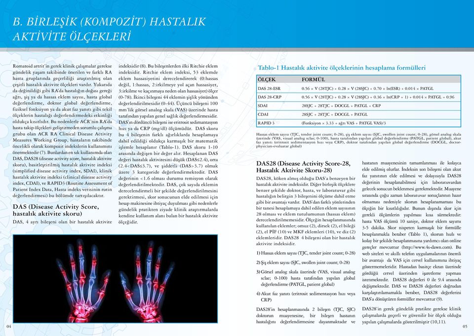 Yukarıda da değinildiği gibi RA da hastalığın doğası gereği ağrı, şiş ya da hassas eklem sayısı, hasta global değerlendirme, doktor global değerlendirme, fiziksel fonksiyon ya da akut faz yanıtı gibi