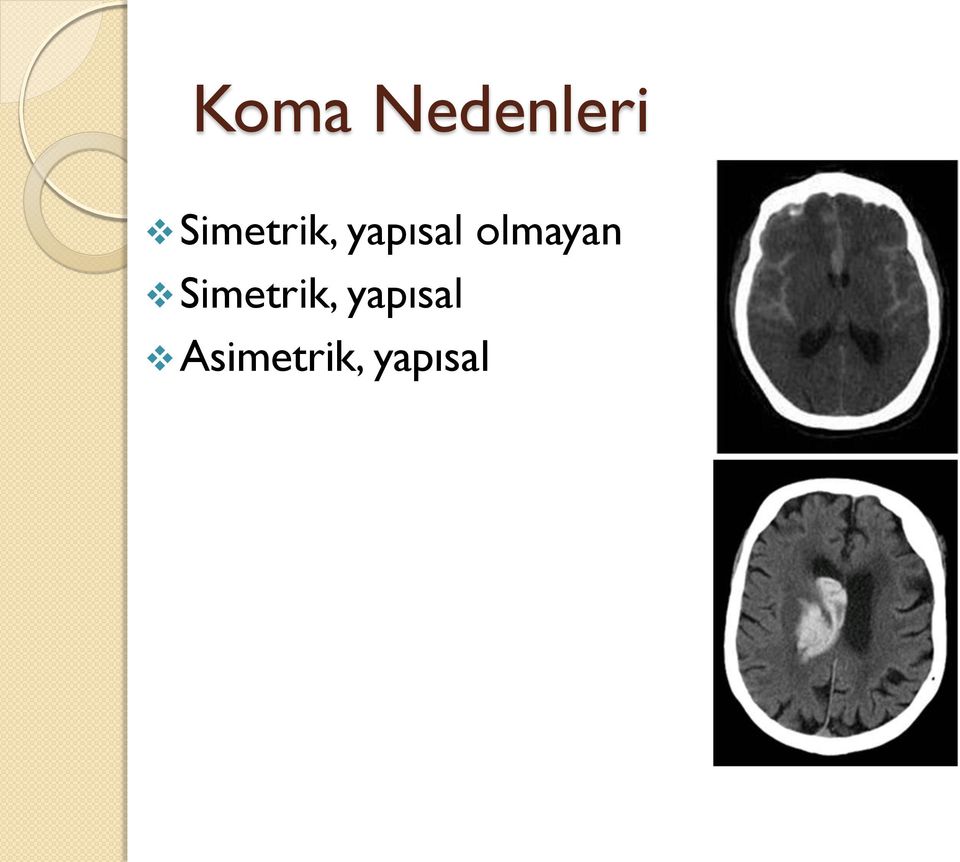 olmayan  Asimetrik,