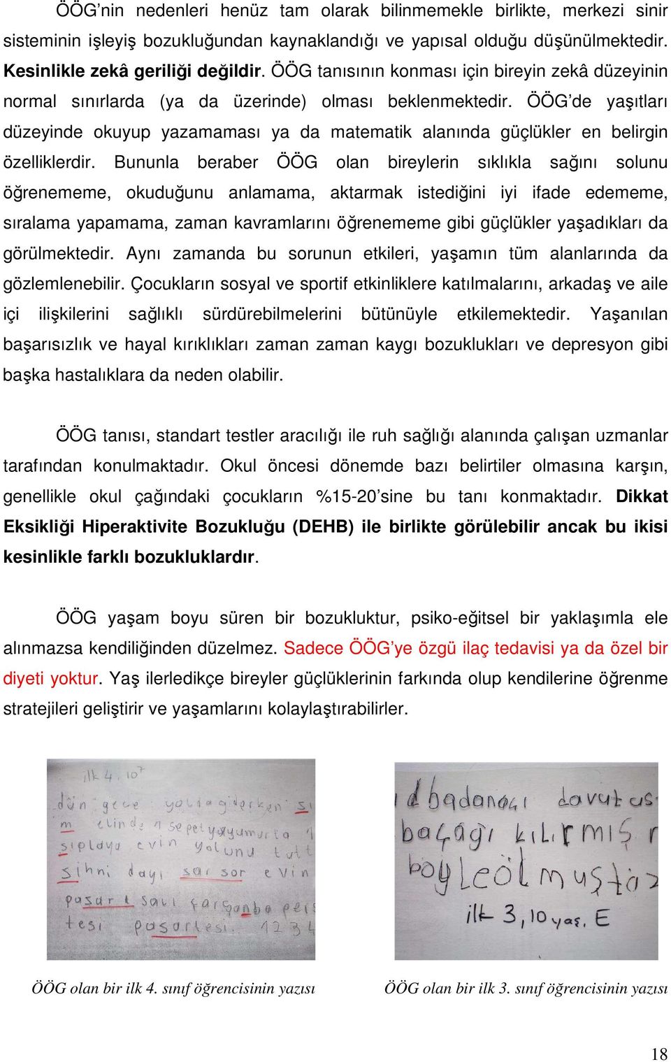 ÖÖG de yaşıtları düzeyinde okuyup yazamaması ya da matematik alanında güçlükler en belirgin özelliklerdir.