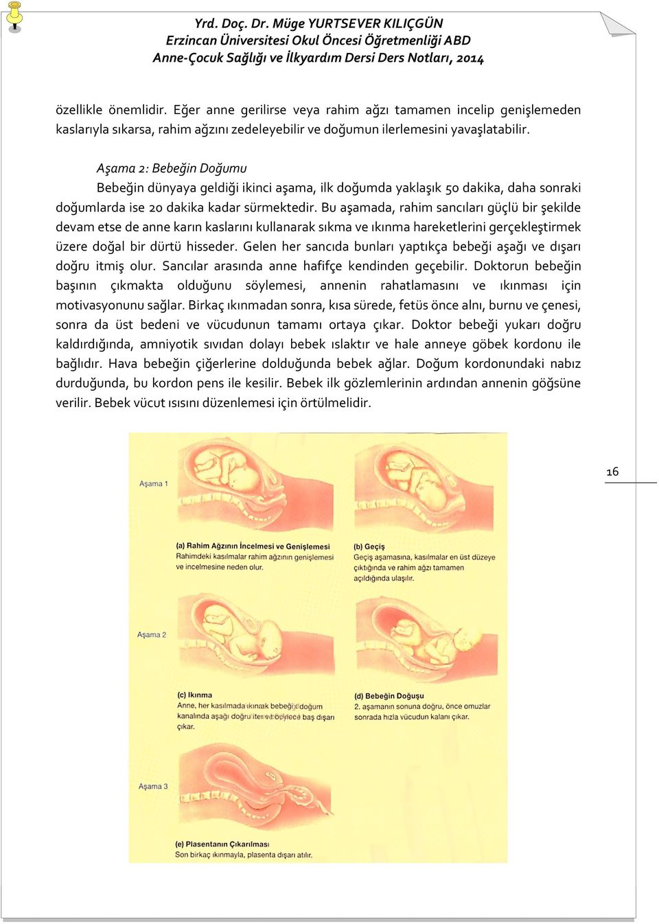 Bu aşamada, rahim sancıları güçlü bir şekilde devam etse de anne karın kaslarını kullanarak sıkma ve ıkınma hareketlerini gerçekleştirmek üzere doğal bir dürtü hisseder.