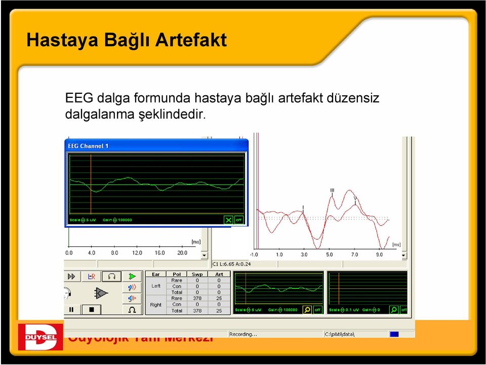 hastaya bağlı artefakt