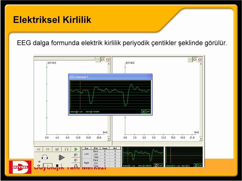 elektrik kirlilik