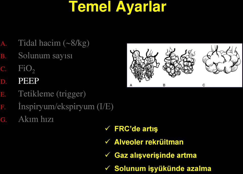 Tetikleme (trigger) F. İnspiryum/ekspiryum (I/E) G.