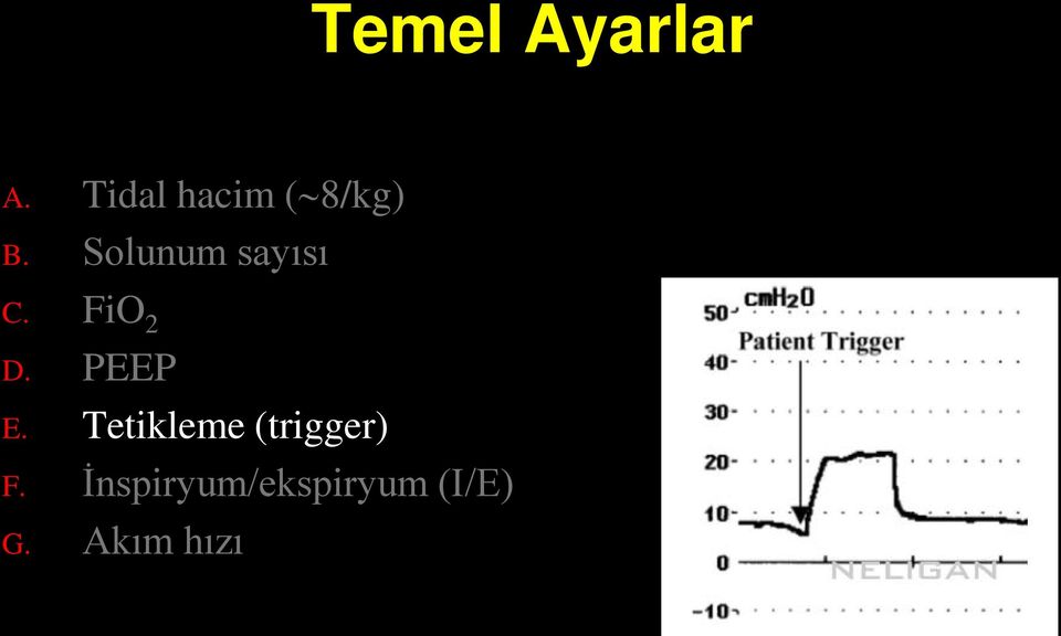 Solunum sayısı C. FiO 2 D. PEEP E.