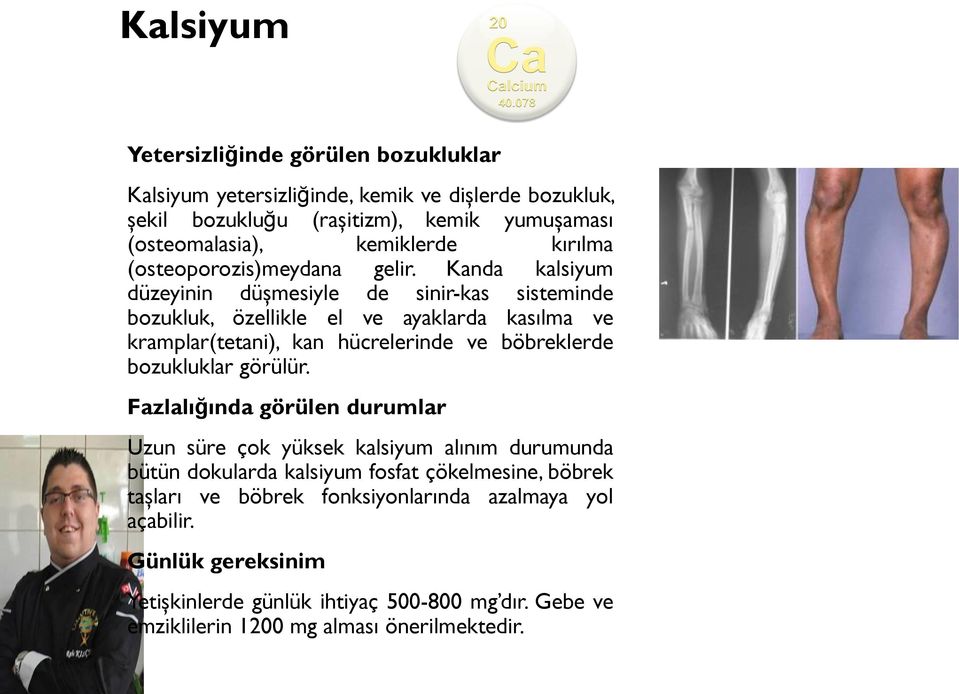 Kanda kalsiyum düzeyinin düşmesiyle de sinir-kas sisteminde bozukluk, özellikle el ve ayaklarda kasılma ve kramplar(tetani), kan hücrelerinde ve böbreklerde bozukluklar