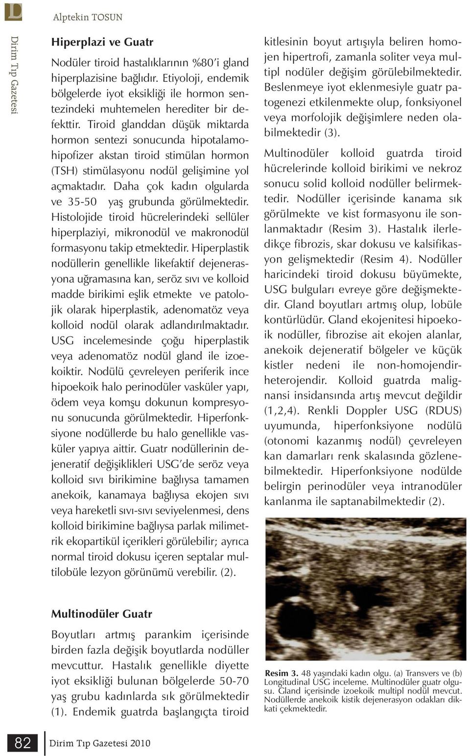 Tiroid glanddan düşük miktarda hormon sentezi sonucunda hipotalamohipofizer akstan tiroid stimülan hormon (TSH) stimülasyonu nodül gelişimine yol açmaktadır.