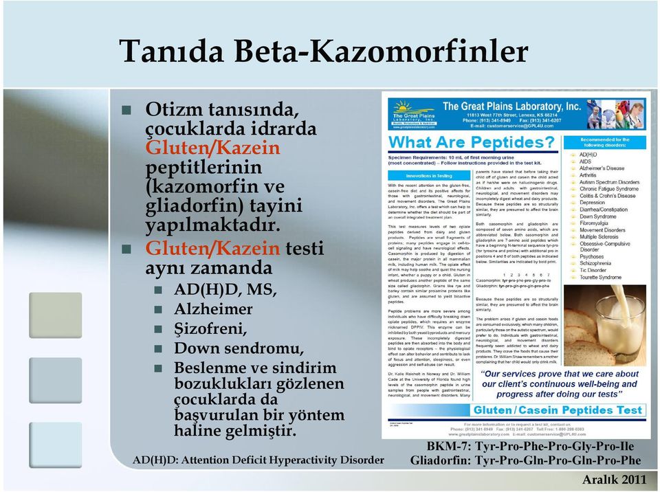 Gluten/Kazein testi aynı zamanda AD(H)D, MS, Alzheimer Şizofreni, Down sendromu, Beslenme ve sindirim