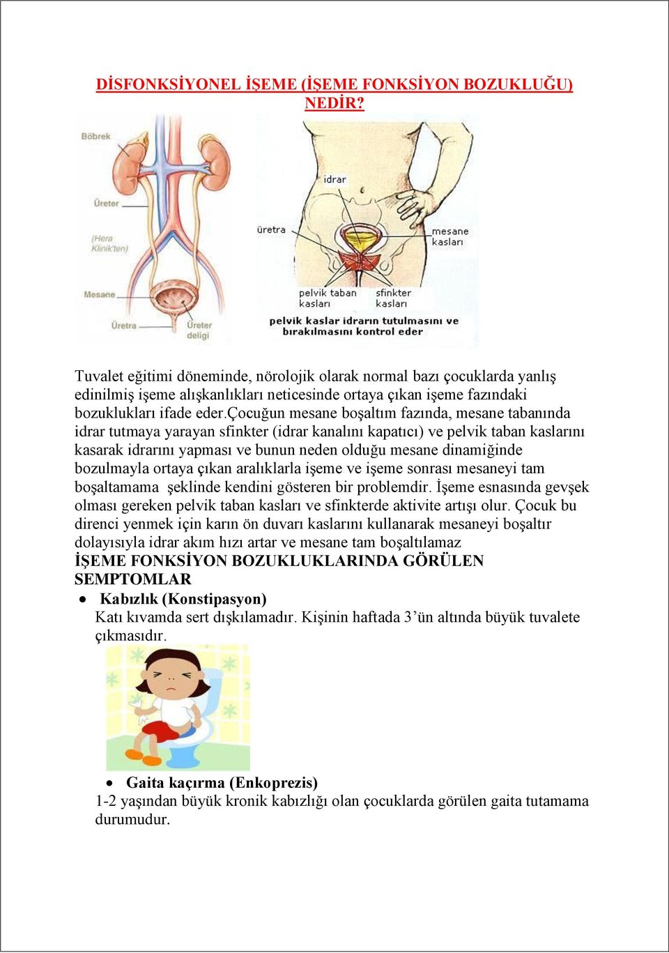 çocuğun mesane boşaltım fazında, mesane tabanında idrar tutmaya yarayan sfinkter (idrar kanalını kapatıcı) ve pelvik taban kaslarını kasarak idrarını yapması ve bunun neden olduğu mesane dinamiğinde