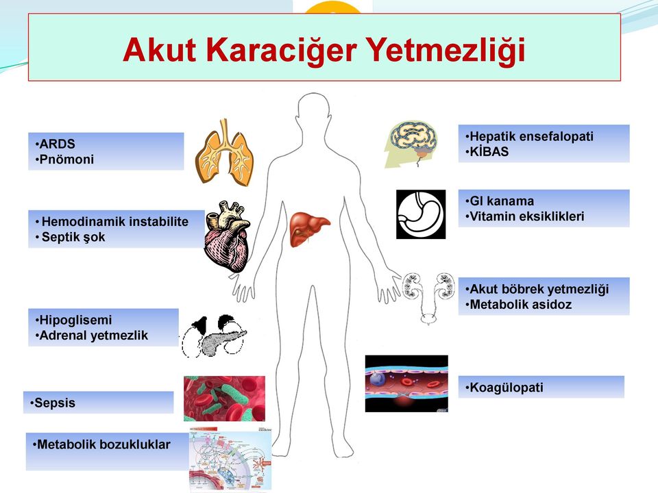 eksiklikleri Hipoglisemi Adrenal yetmezlik Akut böbrek