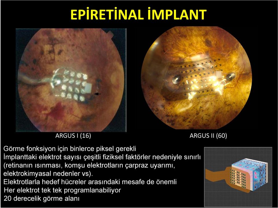 komşu elektrotların çarpraz uyarımı, elektrokimyasal nedenler vs).