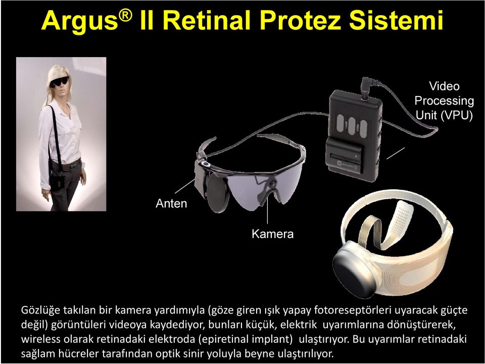 bunları küçük, elektrik uyarımlarına dönüştürerek, wireless olarak retinadaki elektroda (epiretinal