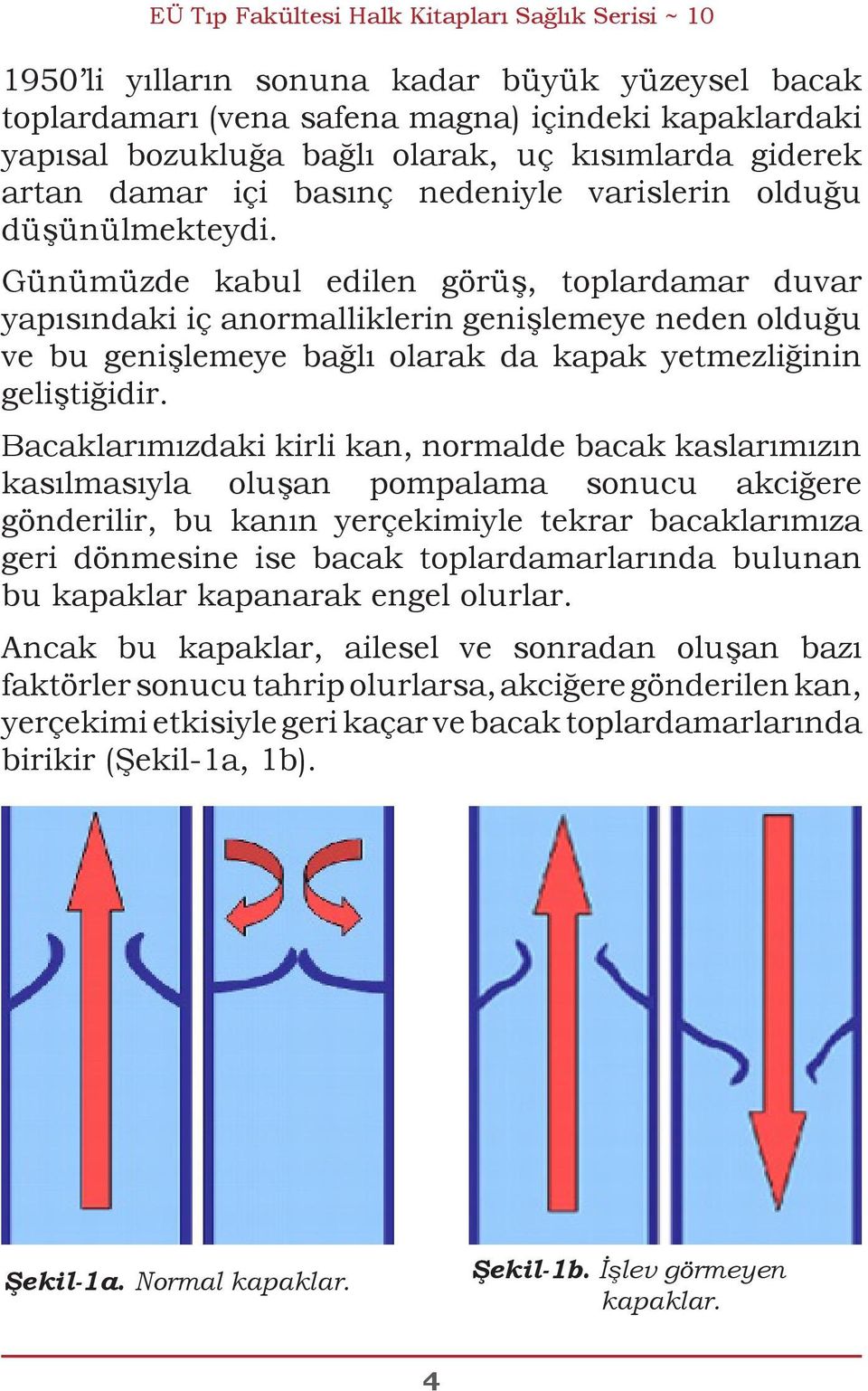 Günümüzde kabul edilen görüş, toplardamar duvar yapısındaki iç anormalliklerin genişlemeye neden olduğu ve bu genişlemeye bağlı olarak da kapak yetmezliğinin geliştiğidir.