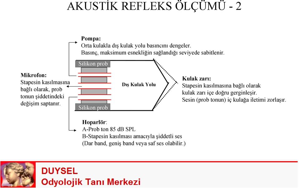 Silikon prob Mikrofon: Stapesin kasılmasına bağlı olarak, prob tonun şiddetindeki değişim saptanır.