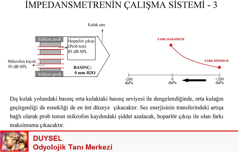 FARK MİNİMUM +200 dapa Dış kulak yolundaki basınç orta kulaktaki basınç seviyesi ile dengelendiğinde, orta kulağın