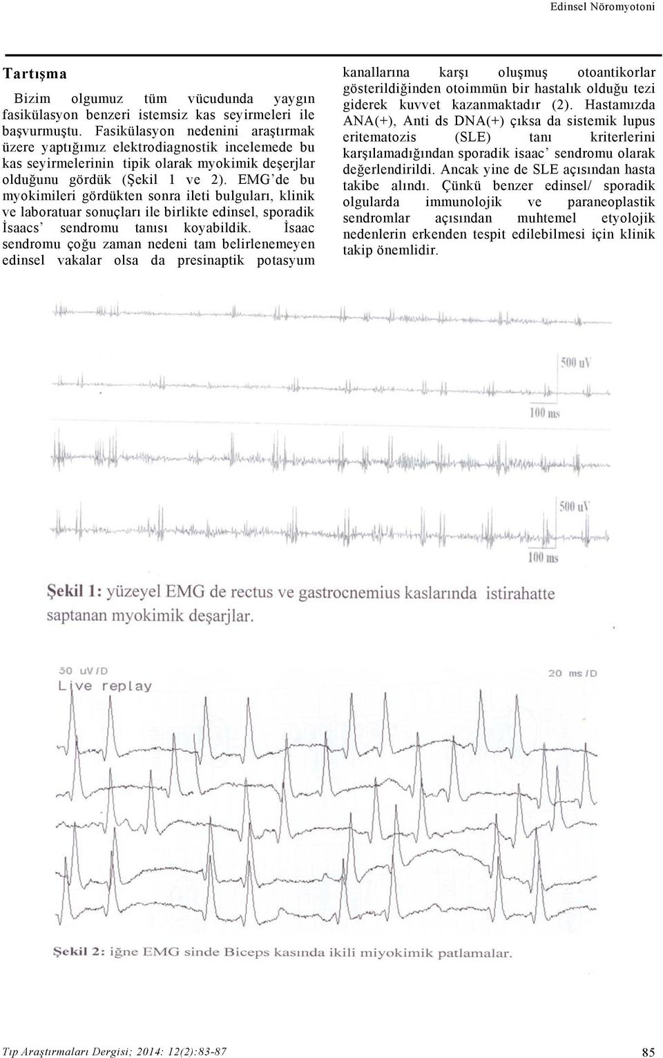 EMG de bu myokimileri gördükten sonra ileti bulguları, klinik ve laboratuar sonuçları ile birlikte edinsel, sporadik İsaacs sendromu tanısı koyabildik.