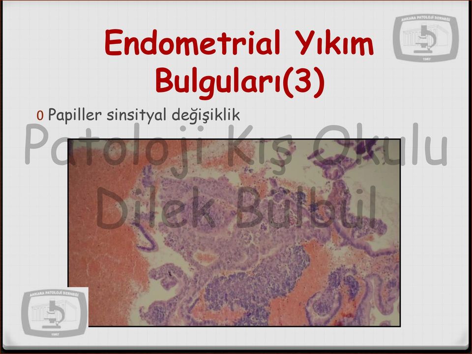 Bulguları(3) 0