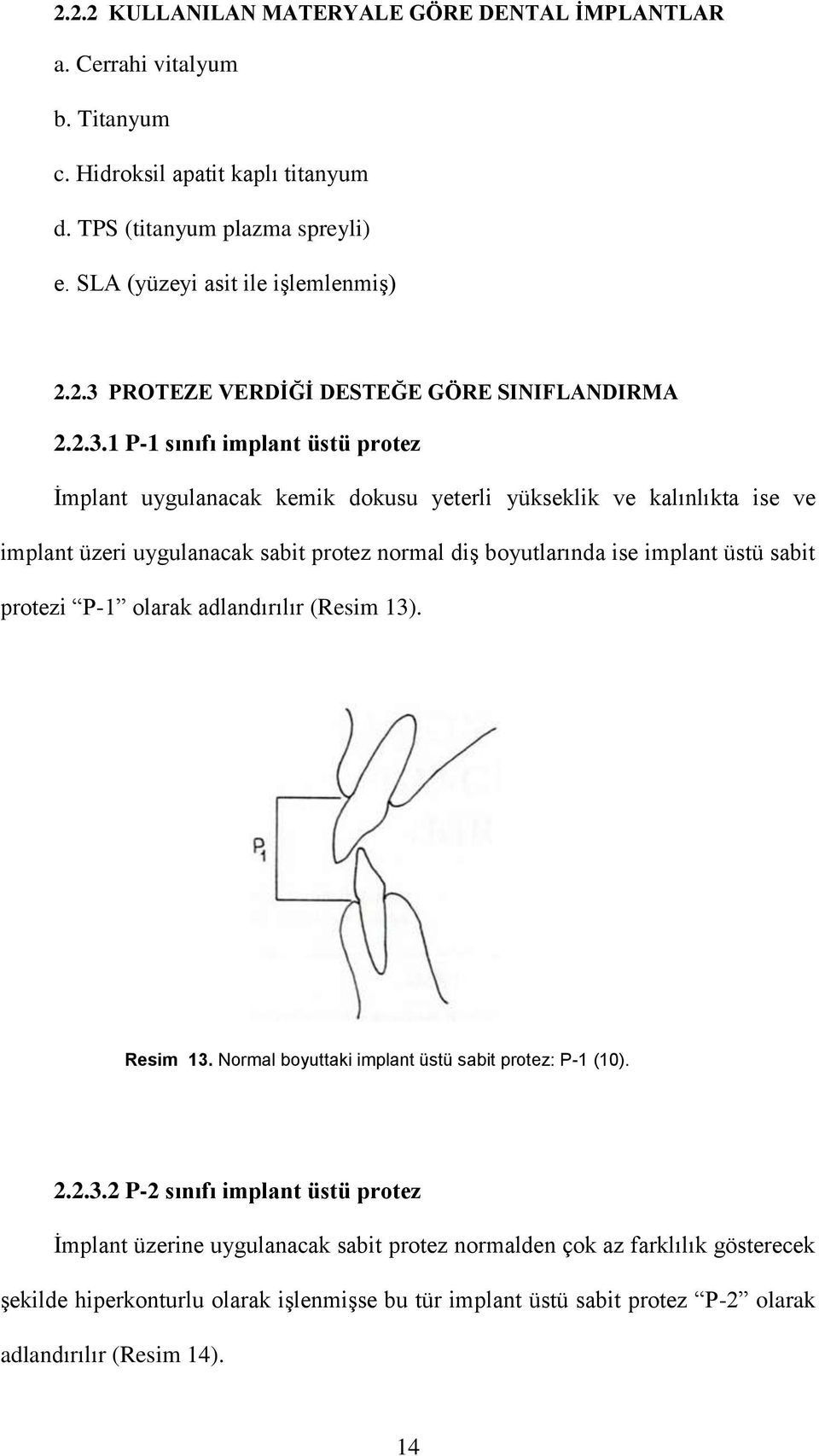 sabit protezi P-1 olarak adlandırılır (Resim 13)