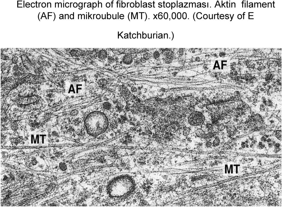 Aktin filament (AF) and