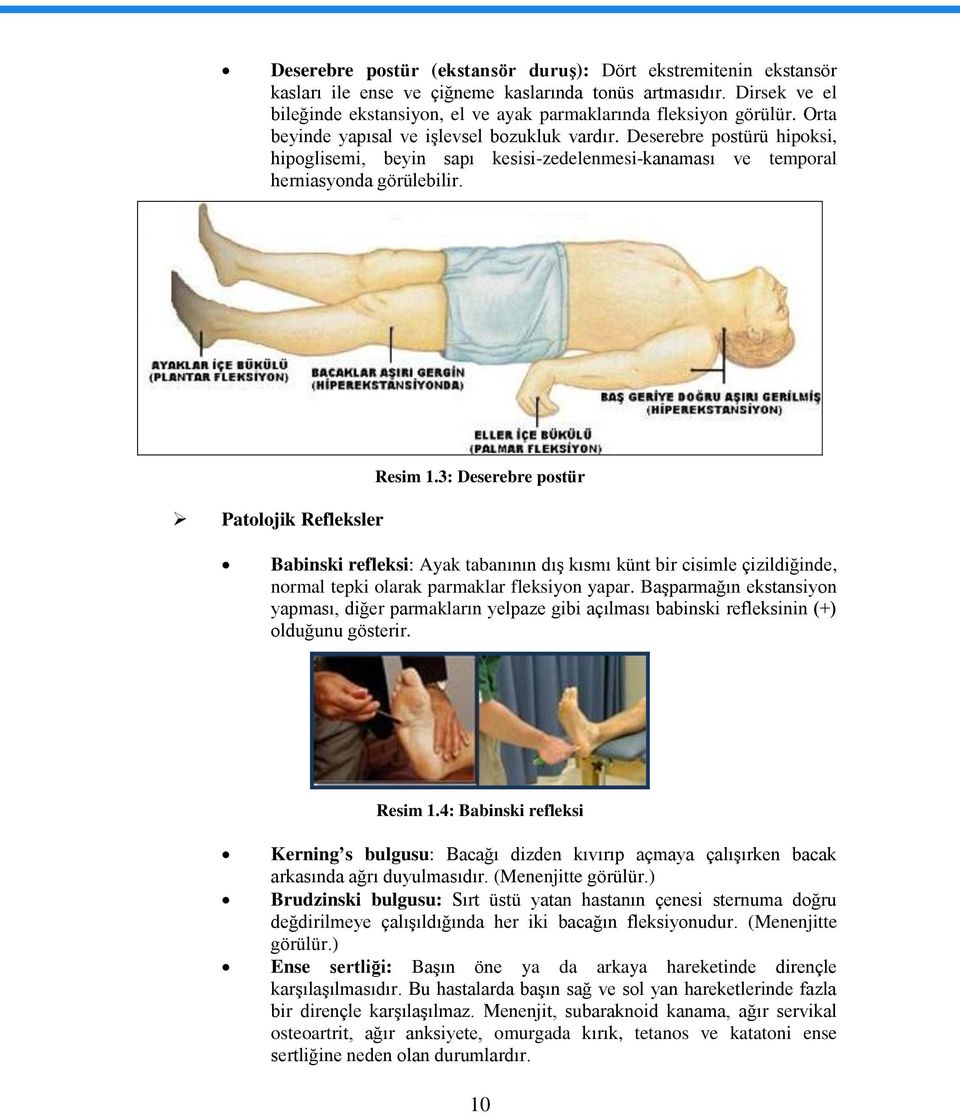 Deserebre postürü hipoksi, hipoglisemi, beyin sapı kesisi-zedelenmesi-kanaması ve temporal herniasyonda görülebilir. Patolojik Refleksler Resim 1.