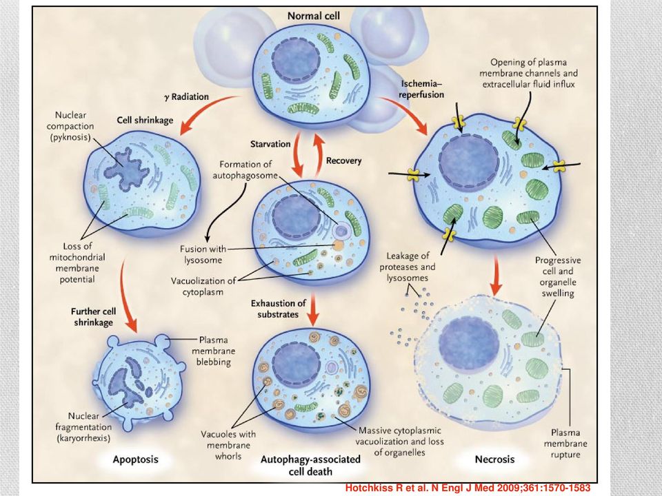 Hotchkiss R et al.