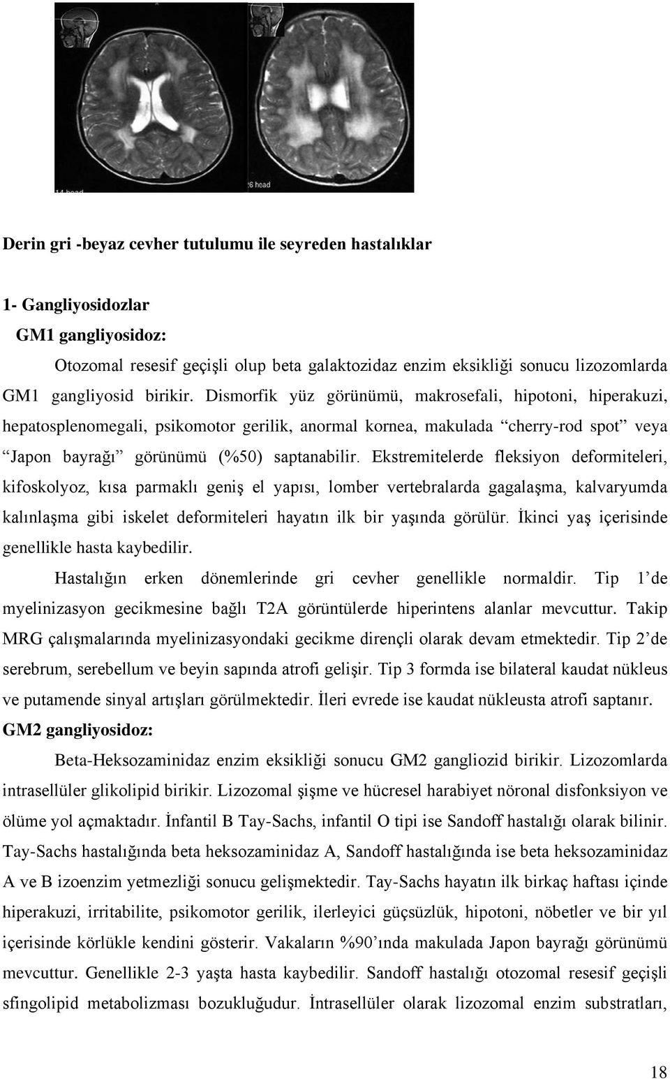 Ekstremitelerde fleksiyon deformiteleri, kifoskolyoz, kısa parmaklı geniş el yapısı, lomber vertebralarda gagalaşma, kalvaryumda kalınlaşma gibi iskelet deformiteleri hayatın ilk bir yaşında görülür.